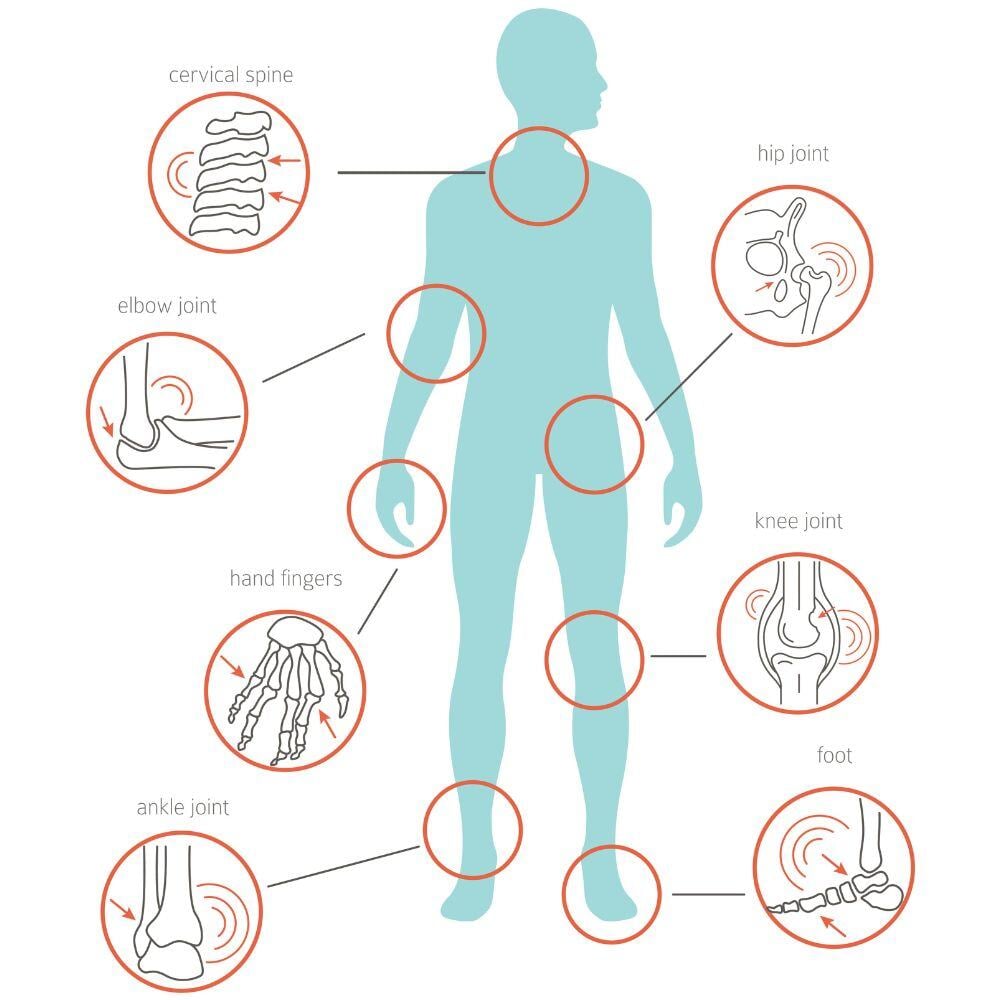 body-parts-affects-by-osteoarthritis